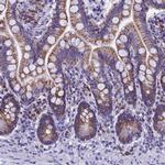 SLC8B1 Antibody in Immunohistochemistry (IHC)