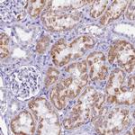 SLC8B1 Antibody in Immunohistochemistry (IHC)