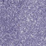 CREB3L3 Polyclonal Antibody