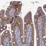CREB3L3 Antibody in Immunohistochemistry (IHC)