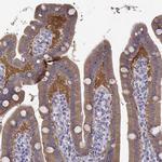 CREB3L3 Antibody in Immunohistochemistry (IHC)