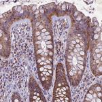 PMPCB Antibody in Immunohistochemistry (Paraffin) (IHC (P))