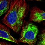 PGM2 Polyclonal Antibody