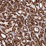 CLYBL Antibody in Immunohistochemistry (Paraffin) (IHC (P))