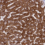 CLYBL Antibody in Immunohistochemistry (Paraffin) (IHC (P))