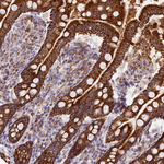 CLYBL Antibody in Immunohistochemistry (Paraffin) (IHC (P))