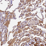 CLYBL Antibody in Immunohistochemistry (Paraffin) (IHC (P))