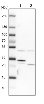 CLYBL Antibody in Western Blot (WB)