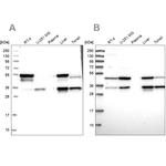 CLYBL Antibody in Western Blot (WB)