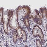 ALS Antibody in Immunohistochemistry (IHC)
