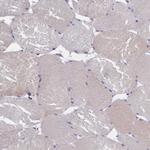 ALS Antibody in Immunohistochemistry (IHC)