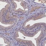 ALS Antibody in Immunohistochemistry (IHC)