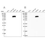 ALS Antibody in Western Blot (WB)