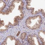 HDHD2 Polyclonal Antibody