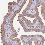 VPS18 Antibody in Immunohistochemistry (Paraffin) (IHC (P))