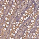 VPS18 Antibody in Immunohistochemistry (Paraffin) (IHC (P))