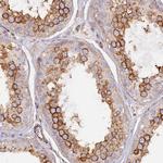 VPS18 Antibody in Immunohistochemistry (Paraffin) (IHC (P))