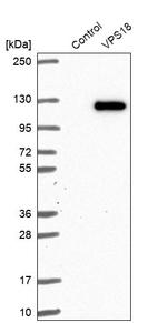 VPS18 Antibody in Western Blot (WB)