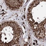 ANKRD12 Antibody in Immunohistochemistry (IHC)