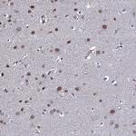 FAM59A Antibody in Immunohistochemistry (Paraffin) (IHC (P))