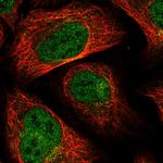 MTFMT Polyclonal Antibody