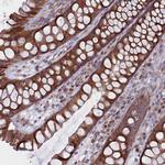 MTFMT Antibody in Immunohistochemistry (Paraffin) (IHC (P))