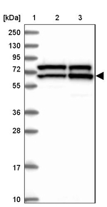 KATNAL2 Antibody in Western Blot (WB)