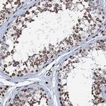 KATNAL2 Polyclonal Antibody