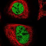 ZMIZ2 Polyclonal Antibody