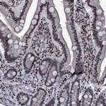 ZMIZ2 Antibody in Immunohistochemistry (Paraffin) (IHC (P))