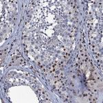ZMIZ2 Antibody in Immunohistochemistry (Paraffin) (IHC (P))