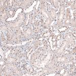 MED20 Antibody in Immunohistochemistry (IHC)