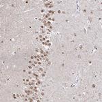 HDGFRP3 Antibody in Immunohistochemistry (IHC)