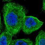 TMEM116 Polyclonal Antibody