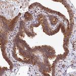 TMEM116 Antibody in Immunohistochemistry (Paraffin) (IHC (P))
