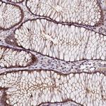 TMEM116 Antibody in Immunohistochemistry (Paraffin) (IHC (P))