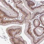 TMEM116 Antibody in Immunohistochemistry (Paraffin) (IHC (P))