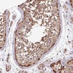 TMEM116 Antibody in Immunohistochemistry (Paraffin) (IHC (P))