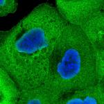 CALML5 Polyclonal Antibody