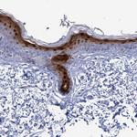 CALML5 Antibody in Immunohistochemistry (Paraffin) (IHC (P))