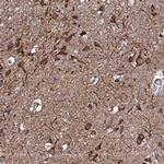 RAB12 Antibody in Immunohistochemistry (Paraffin) (IHC (P))