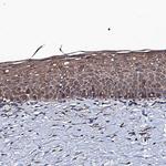 RAB12 Antibody in Immunohistochemistry (Paraffin) (IHC (P))