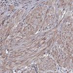RAB12 Antibody in Immunohistochemistry (Paraffin) (IHC (P))