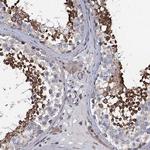 KCTD4 Polyclonal Antibody