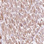 RASSF1 Antibody in Immunohistochemistry (Paraffin) (IHC (P))