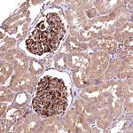 RASSF1 Antibody in Immunohistochemistry (Paraffin) (IHC (P))