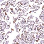RASSF1 Antibody in Immunohistochemistry (Paraffin) (IHC (P))