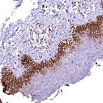 RASSF1 Polyclonal Antibody