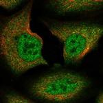 SPIRE1 Polyclonal Antibody