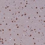 SPIRE1 Antibody in Immunohistochemistry (Paraffin) (IHC (P))